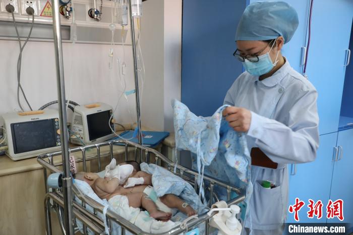 儿科医院重症监护病房(NICU)精心照顾联体姐妹。儿科医院供图