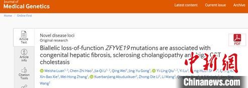 中外专家携手发现新遗传性肝病锁定致病基因